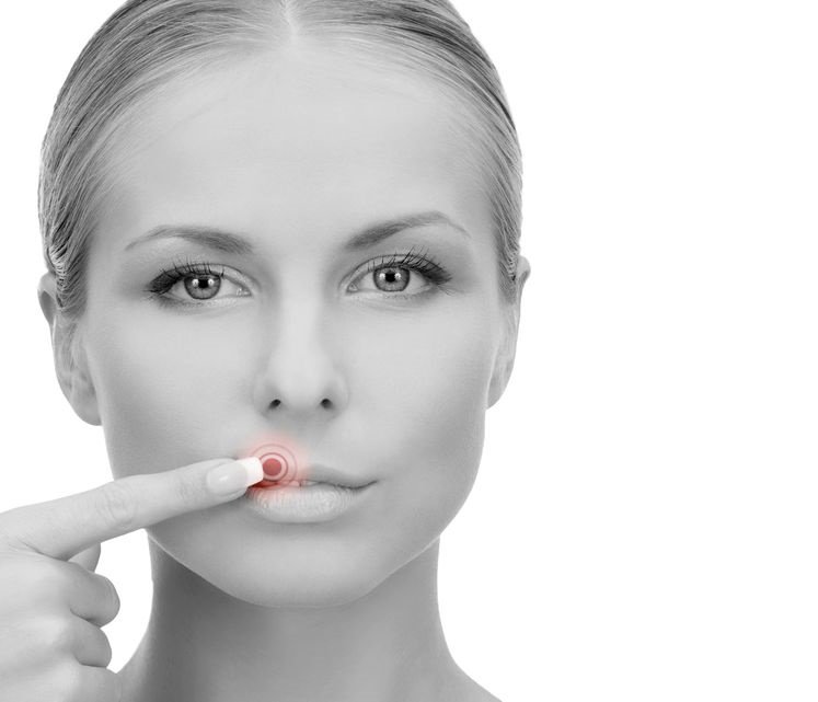 EL PROPÓLEO Para los fuegos labiales